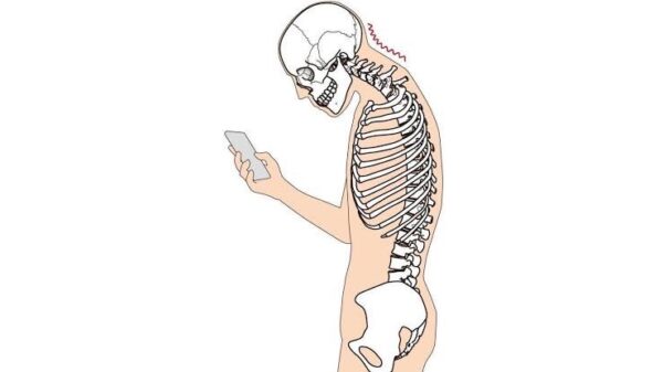 川崎大師の整骨院が解説！肩こりとストレートネックの深い関係と骨格矯正の効果