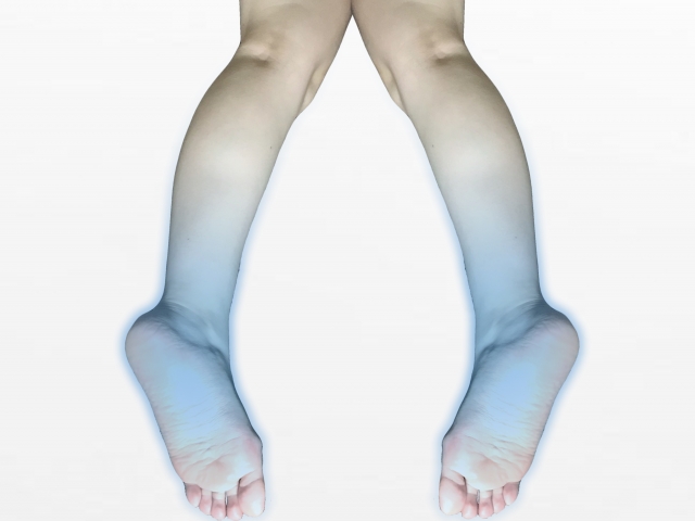 手足の冷えは筋肉が働いていないサイン｜川崎大師の整骨院で根本改善